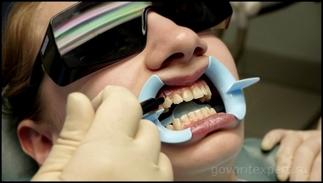 Как отбелить зубы? Говорит ЭКСПЕРТ